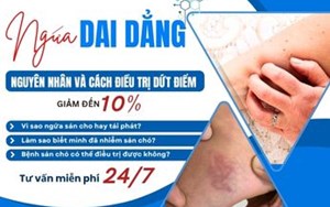 NGỨA DAI DẲNG? NGUYÊN NHÂN VÀ CÁCH ĐIỀU TRỊ DỨT ĐIỂM
